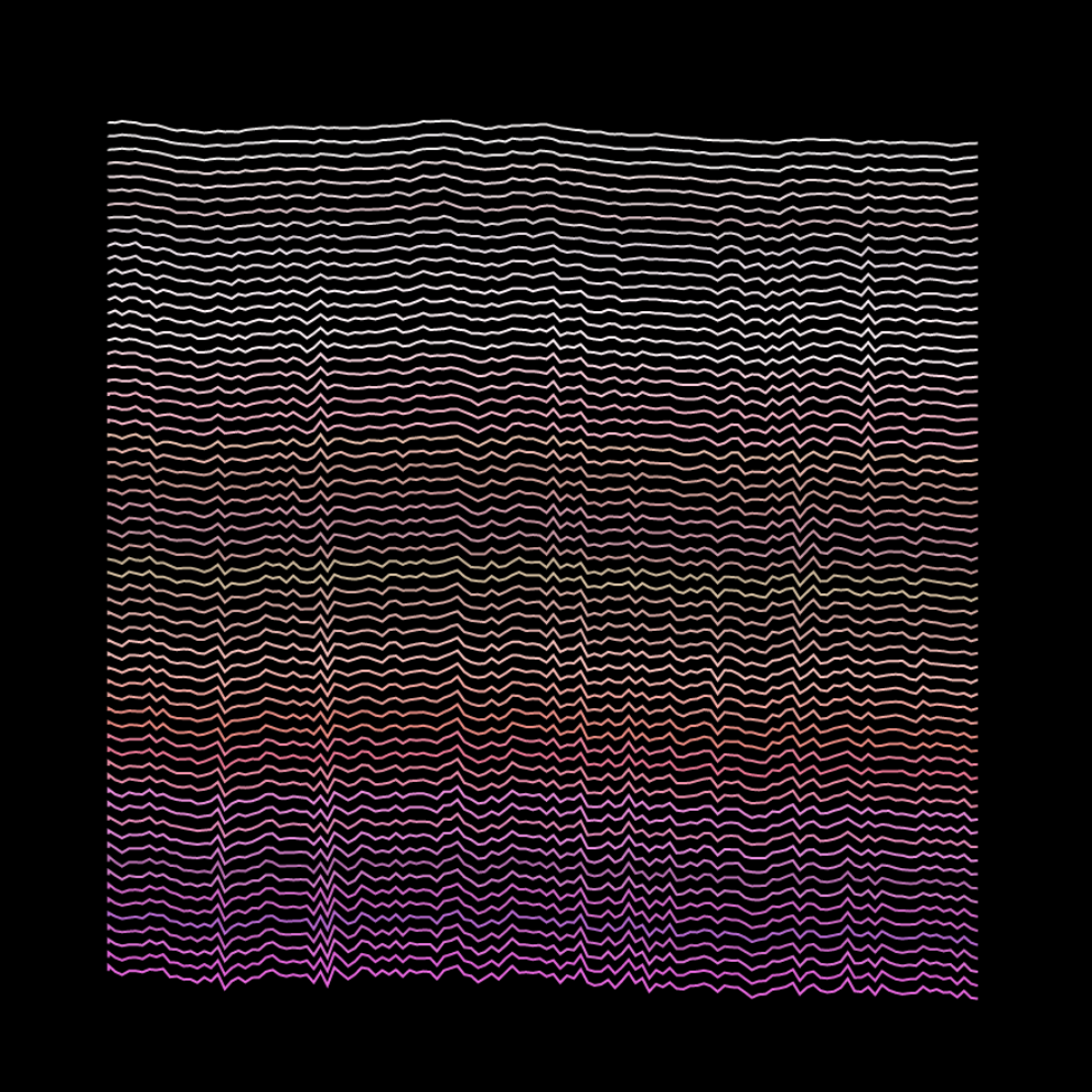 Sol LeWitt Wall Drawing